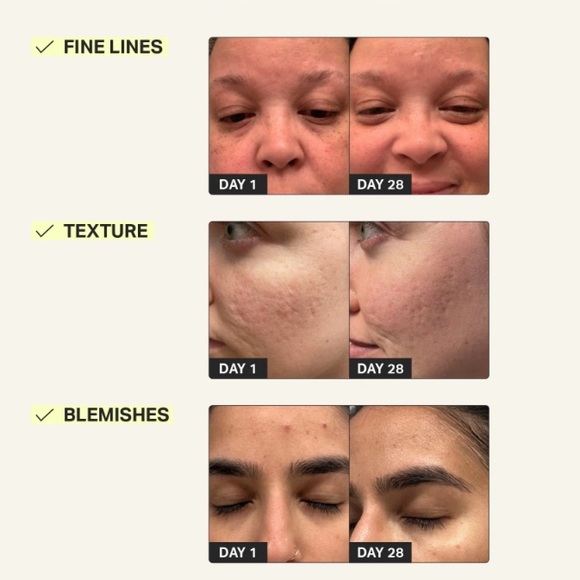 Brand new cocokind beginner retinol gel - Picture 2 of 6